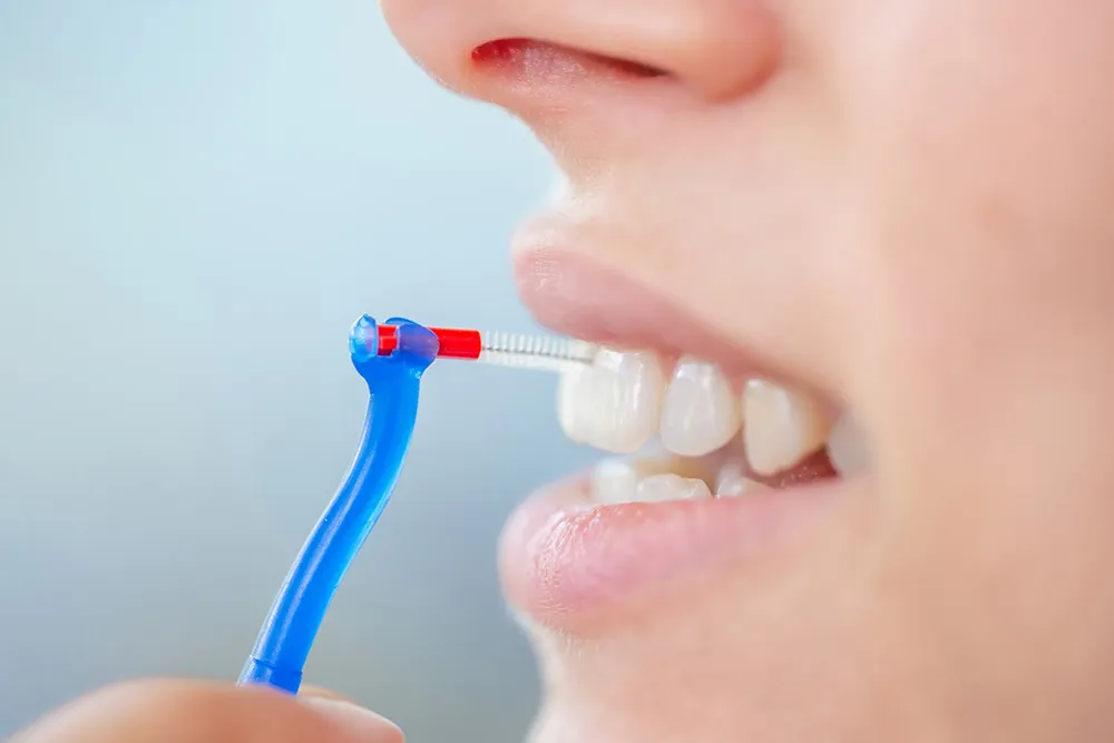 Det korrekta sättet att använda en interdentalborste